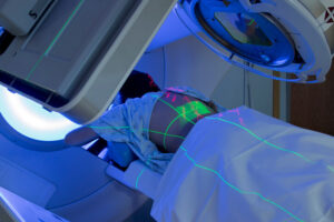 What to Expect When Having Radiation Therapy